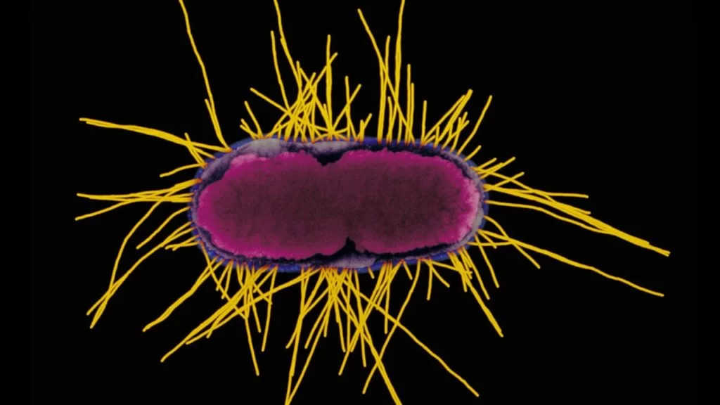Ecoli_1280p
